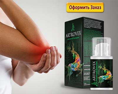 Об артровексе хорошо отзываются покупатели