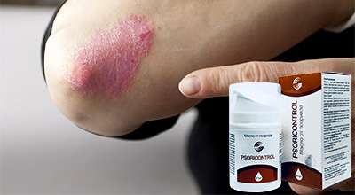 psoricontrol-ot-psoriaza