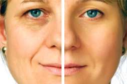 Средство Platinum Mask даёт результат, равноценный хирургической пластике.