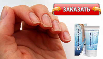 Дерматизон купить в аптеке.