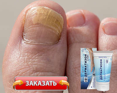 Гель Дерматизон купить по доступной цене.