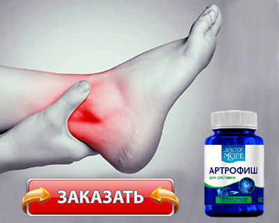 Таблетки Артрофиш купить по доступной цене.